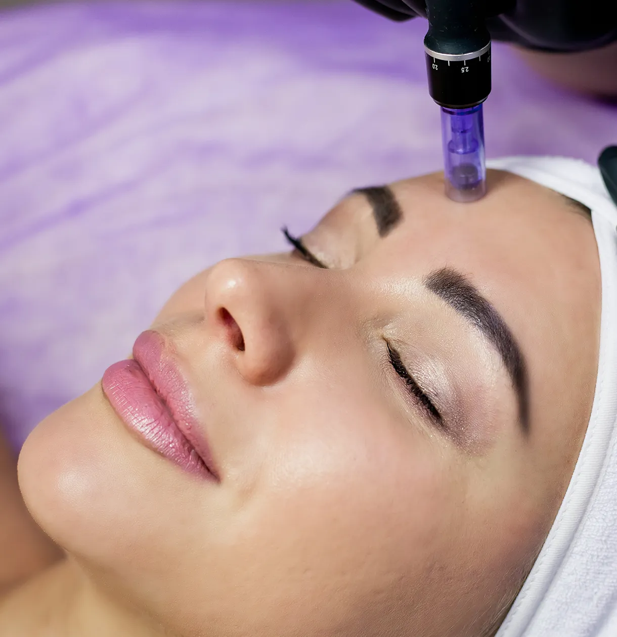 Microneedling ADN Saumon chez Eyelight